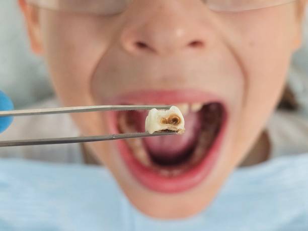 Best Weekend Emergency Dental Services in Laurel, VA