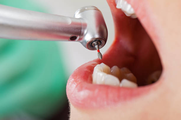 Best Emergency Dental Care for Sports Injuries in Laurel, VA